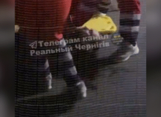 Черепно-мозкова травма та струс: обласний ТЦК та СП прокоментував інцидент на Чернігівщині