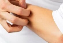 Паразитарне захворювання шкіри набирає обертів: що варто знати жителям Чернігівщини