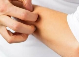 Паразитарне захворювання шкіри набирає обертів: що варто знати жителям Чернігівщини