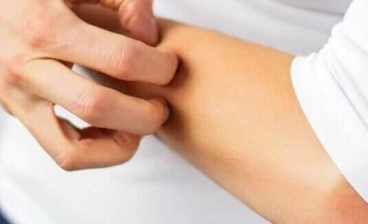 Паразитарне захворювання шкіри набирає обертів: що варто знати жителям Чернігівщини