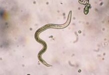 ВОЗ застерігає: "гібридні паразити" шистосомозу, що вражають внутрішні органи, можуть поширитися по всьому світу