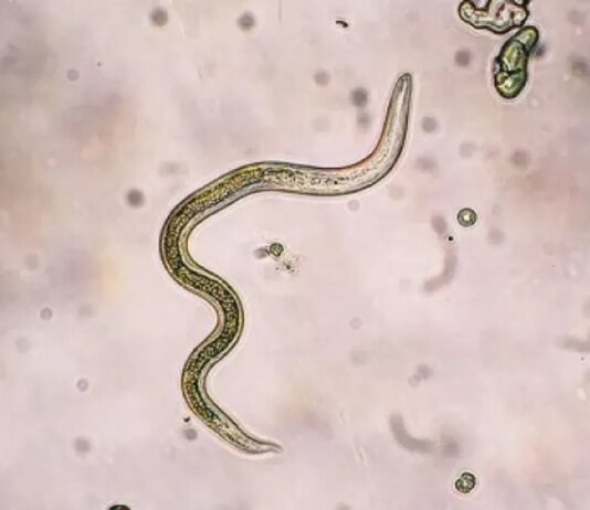 ВОЗ застерігає: "гібридні паразити" шистосомозу, що вражають внутрішні органи, можуть поширитися по всьому світу