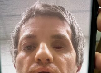 У Чернігові поліцейські напали на ветерана, після чого у нього стався епілептичний напад