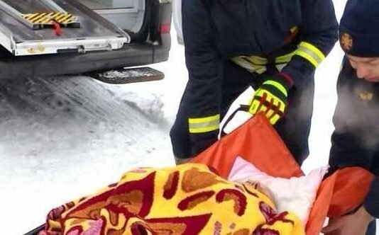 На Чернігівщині в пожежі дитина отруїлася чадним газом та отримала опіки