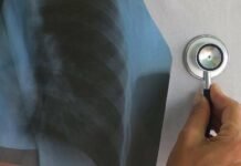 На Чернігівщині захворюваність на туберкульоз зросла майже на 19%: за 2025 рік захворіли 328 людей