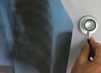 На Чернігівщині захворюваність на туберкульоз зросла майже на 19%: за 2025 рік захворіли 328 людей