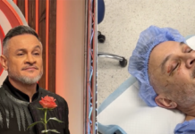 54-летний Эктор Хименес-Браво лег под нож: что он сделал с лицом (фото)