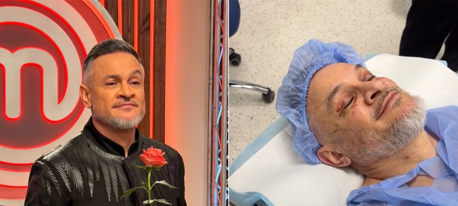 54-летний Эктор Хименес-Браво лег под нож: что он сделал с лицом (фото)