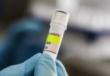 Перший випадок хантавірусу у Франції виявили в евакуйованої пасажирки лайнера