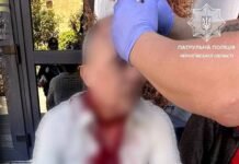 У Чернігові чоловіку розбили голову під час конфлікту: його врятували патрульні