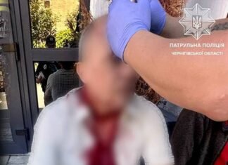 У Чернігові чоловіку розбили голову під час конфлікту: його врятували патрульні