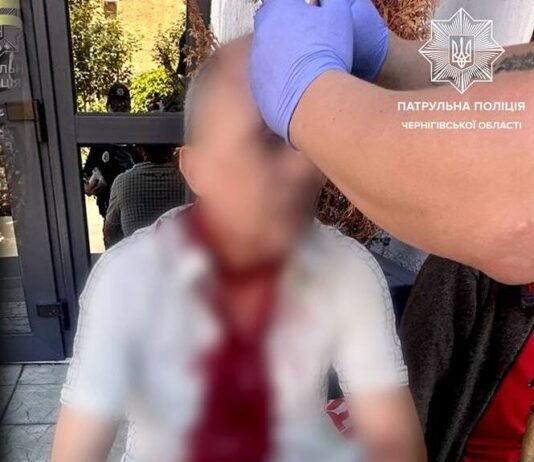У Чернігові чоловіку розбили голову під час конфлікту: його врятували патрульні