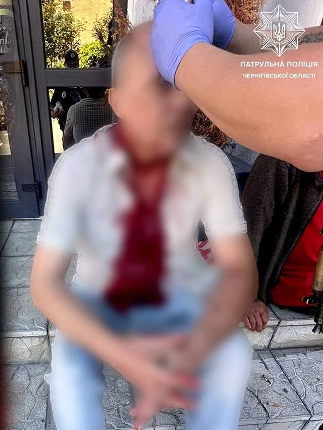 У Чернігові чоловіку розбили голову під час конфлікту: його врятували патрульні