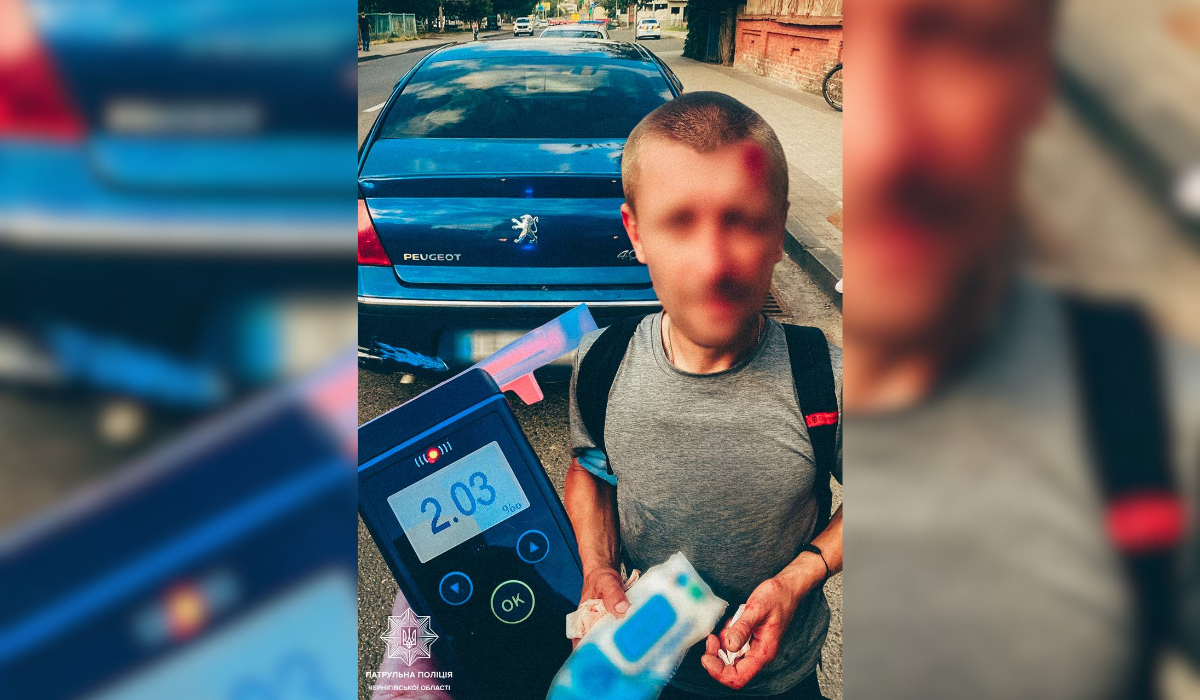 У Чернігові пʼячний велосипедист потрапив у ДТП та отримав травму голови