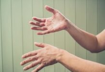 Троє дітей захворіли на кір після відпочинку на Закарпатті: на Чернігівщині закликають перевірити щеплення